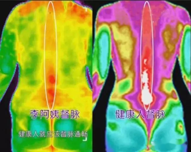 紅外熱成像可以看病？了解一下醫療診斷應用
