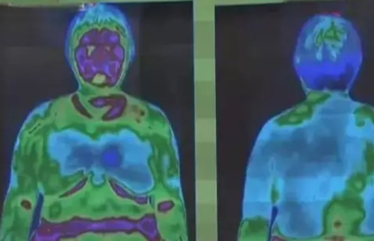 紅外熱成像儀檢查：身體健康狀況如何，只需一掃就能全看清