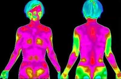 中醫領域可以用紅外技術做哪些檢查？